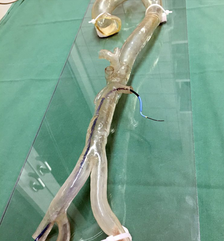Case Study: Uniklinik Mainz verbessert vaskuläre Operationen mit 3D-Druck